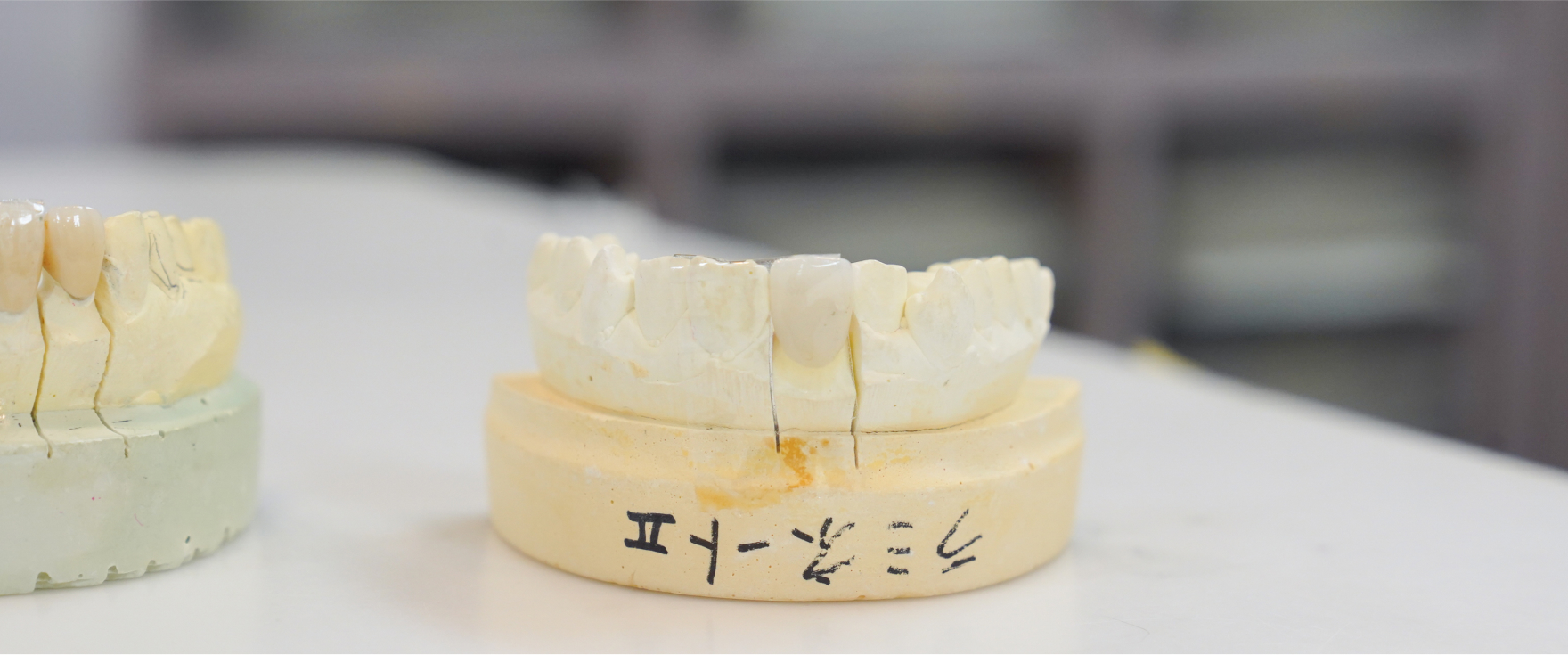 詰め物・被せ物